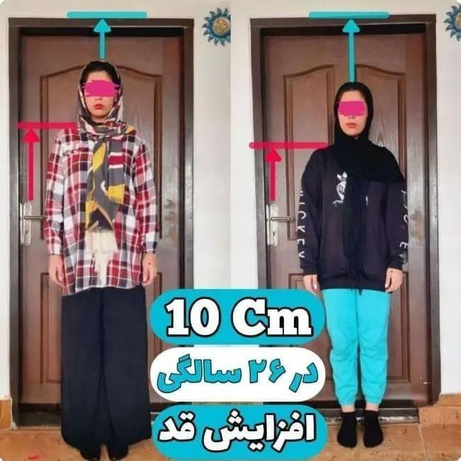 پکیج افزایش قد طبیعی تضمینی | رشد هدفمند قد با مصرف منظم